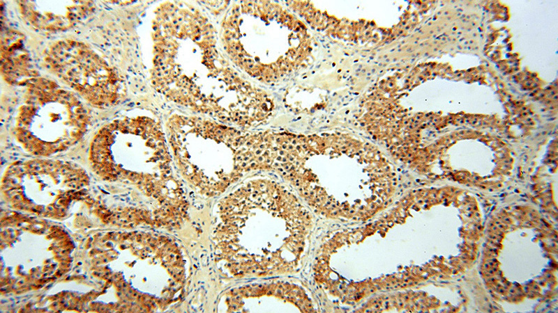 Immunohistochemical of paraffin-embedded human testis using Catalog No:109783(CYTL1 antibody) at dilution of 1:100 (under 10x lens)