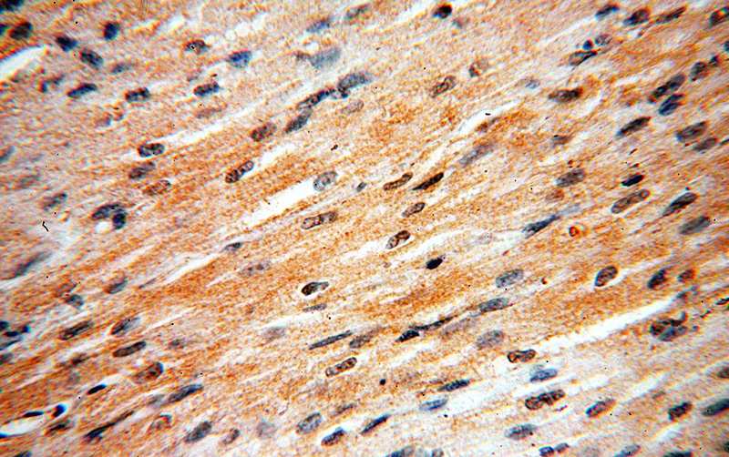 Immunohistochemical of paraffin-embedded human heart using Catalog No:112432(MAPK12 antibody) at dilution of 1:100 (under 40x lens)