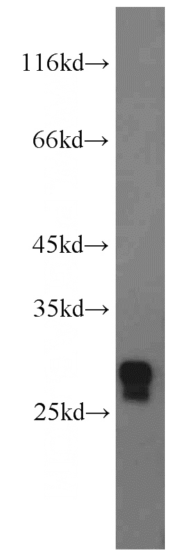 mouse liver tissue were subjected to SDS PAGE followed by western blot with Catalog No:111195(GSTZ1 antibody) at dilution of 1:800