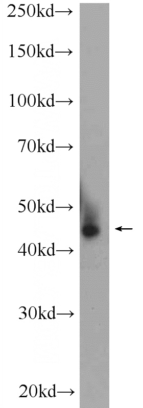 HepG2 cells were subjected to SDS PAGE followed by western blot with Catalog No:117083(AZI2 Antibody) at dilution of 1:1000