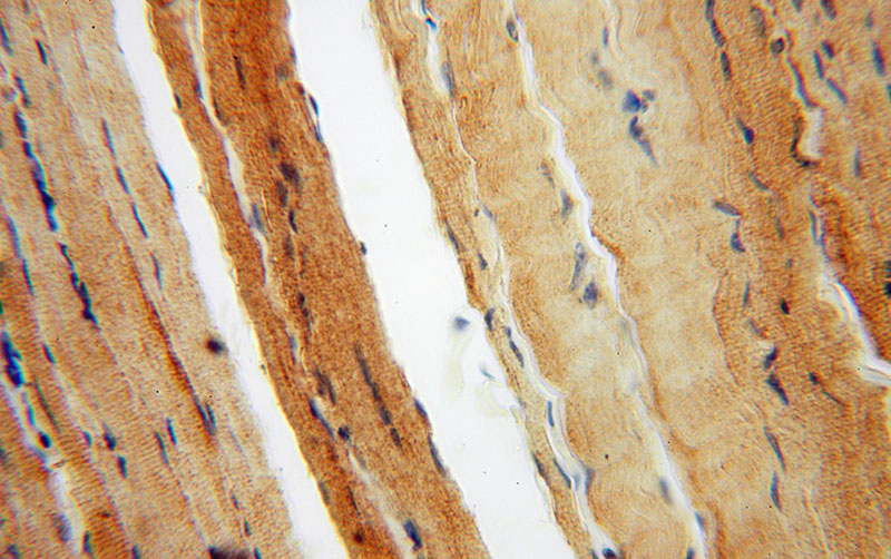 Immunohistochemical of paraffin-embedded human skeletal muscle using Catalog No:112004(KIF1B antibody) at dilution of 1:50 (under 40x lens)