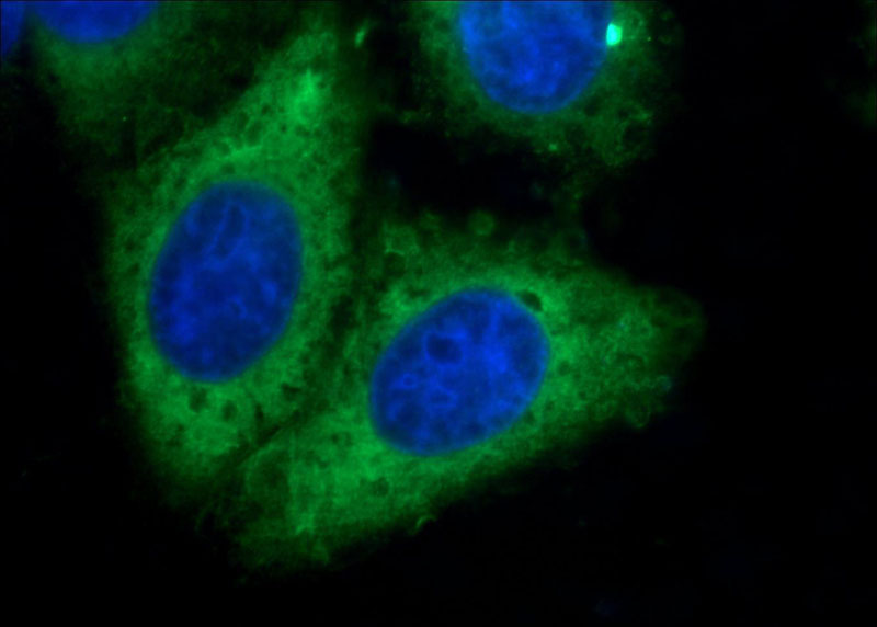 Immunofluorescent analysis of HepG2 cells using Catalog No:107512(RRM1 Antibody) at dilution of 1:50 and Alexa Fluor 488-congugated AffiniPure Goat Anti-Mouse IgG(H+L)