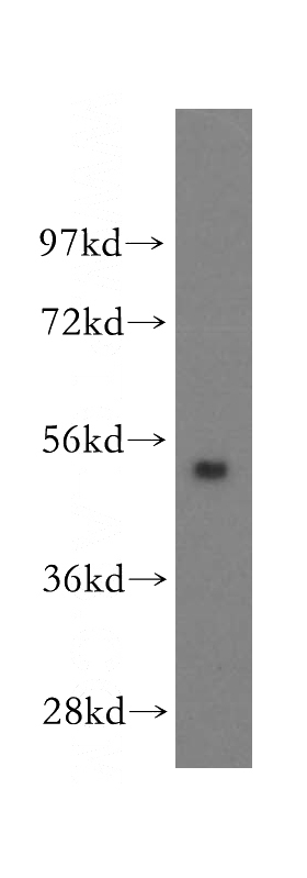 human liver tissue were subjected to SDS PAGE followed by western blot with Catalog No:110560(FBXO9 antibody) at dilution of 1:300