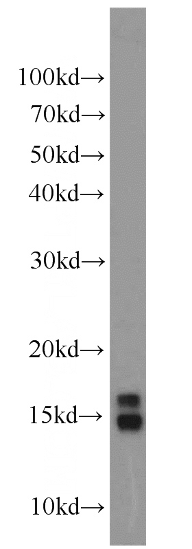 Raji cells were subjected to SDS PAGE followed by western blot with Catalog No:111404(H2AFX antibody) at dilution of 1:1000