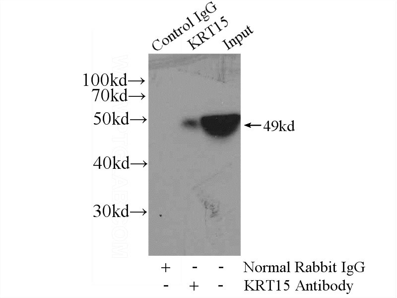 IP Result of anti-KRT15 (IP:Catalog No:109794, 4ug; Detection:Catalog No:109794 1:500) with A431 cells lysate 3040ug.