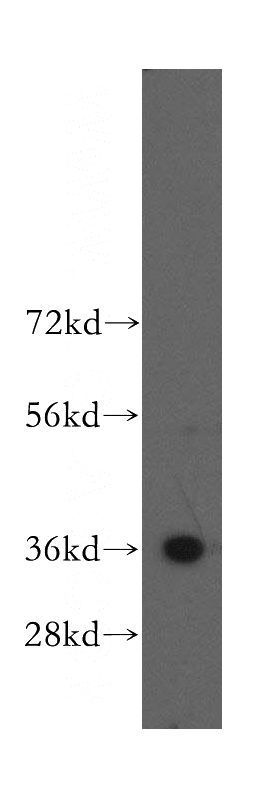 HeLa cells were subjected to SDS PAGE followed by western blot with Catalog No:112713(MNAT1 antibody) at dilution of 1:500