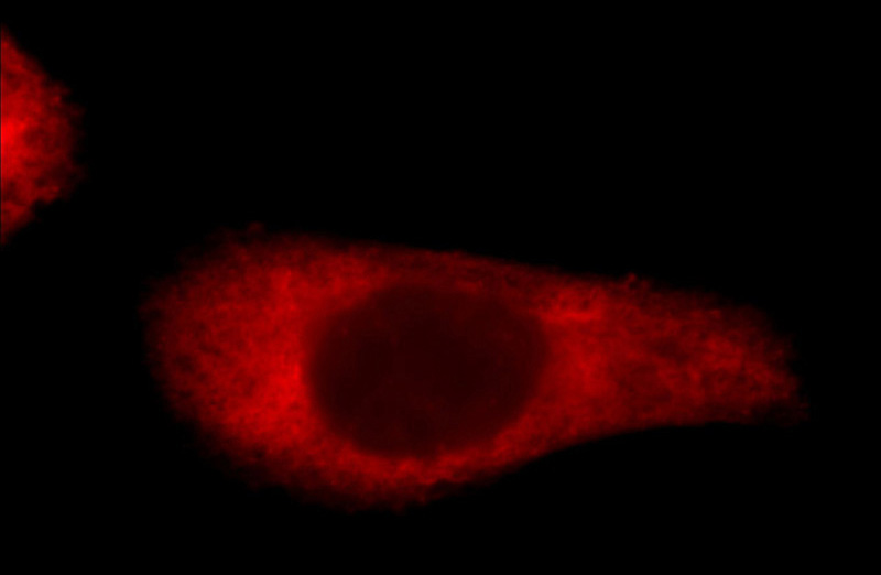 Immunofluorescent analysis of A431 cells using Catalog No:112297(LOR Antibody) at dilution of 1:25 and Rhodamine-Goat anti-Rabbit IgG