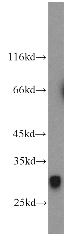 human placenta tissue were subjected to SDS PAGE followed by western blot with Catalog No:107763(ADAM17-Specific antibody) at dilution of 1:500