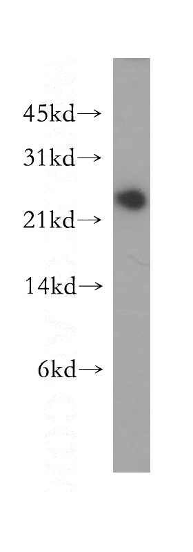 MCF7 cells were subjected to SDS PAGE followed by western blot with Catalog No:111224(GRPEL1 antibody) at dilution of 1:500
