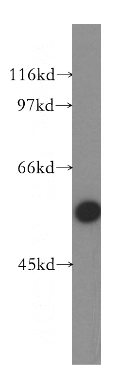 A375 cells were subjected to SDS PAGE followed by western blot with Catalog No:115364(SLC30A6 antibody) at dilution of 1:500