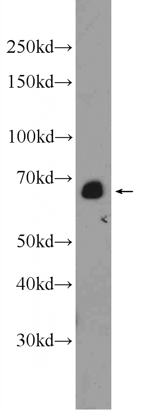 HepG2 cells were subjected to SDS PAGE followed by western blot with Catalog No:110415(EXOSC9 Antibody) at dilution of 1:1000