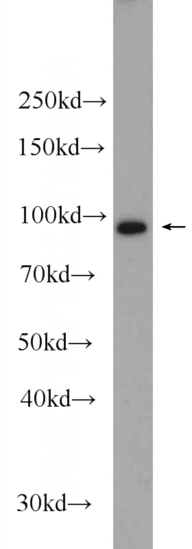 HeLa cells were subjected to SDS PAGE followed by western blot with Catalog No:108219(ASCC2 Antibody) at dilution of 1:1000