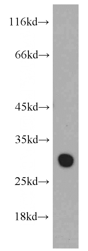 HEK-293 cells were subjected to SDS PAGE followed by western blot with Catalog No:117345(VDAC1 antibody) at dilution of 1:500