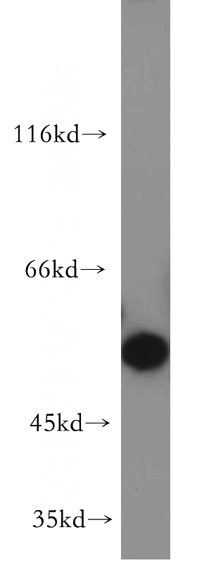 HEK-293 cells were subjected to SDS PAGE followed by western blot with Catalog No:108371(BBS4 antibody) at dilution of 1:500