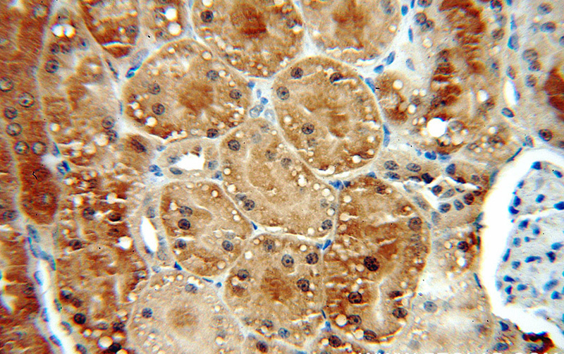 Immunohistochemical of paraffin-embedded human kidney using Catalog No:111021(GLI2-Specific antibody) at dilution of 1:50 (under 40x lens)
