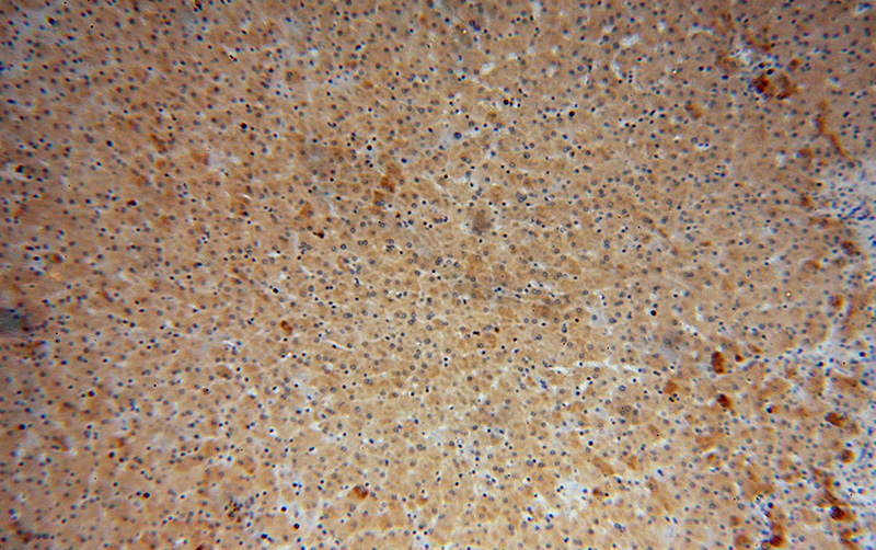 Immunohistochemical of paraffin-embedded human liver using Catalog No:107750(ACOX2 antibody) at dilution of 1:50 (under 10x lens)