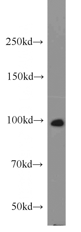 HeLa cells were subjected to SDS PAGE followed by western blot with Catalog No:116613(UNC45A antibody) at dilution of 1:1000