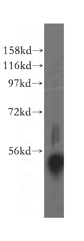 mouse pancreas tissue were subjected to SDS PAGE followed by western blot with Catalog No:116552(UFSP2 antibody) at dilution of 1:400