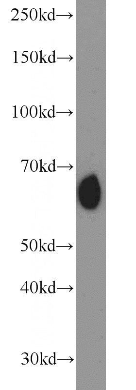 mouse kidney tissue were subjected to SDS PAGE followed by western blot with Catalog No:114565(RBPJ antibody) at dilution of 1:1000