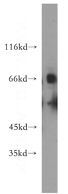 mouse kidney tissue were subjected to SDS PAGE followed by western blot with Catalog No:115316(SLC22A2 antibody) at dilution of 1:300
