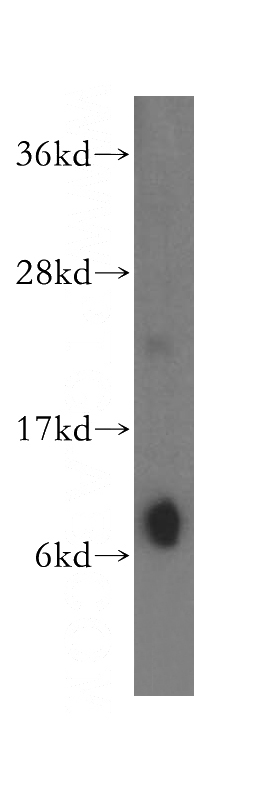 human heart tissue were subjected to SDS PAGE followed by western blot with Catalog No:109486(COX17 antibody) at dilution of 1:300