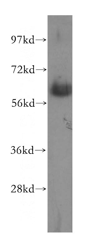 human stomach tissue were subjected to SDS PAGE followed by western blot with Catalog No:115656(SPTLC2 antibody) at dilution of 1:300