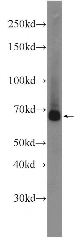 HeLa cells were subjected to SDS PAGE followed by western blot with Catalog No:110639(FGFBP3 Antibody) at dilution of 1:600