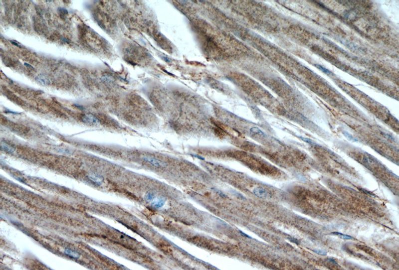 Immunohistochemistry of paraffin-embedded human heart tissue slide using Catalog No:109896(DES Antibody) at dilution of 1:50 (under 40x lens)