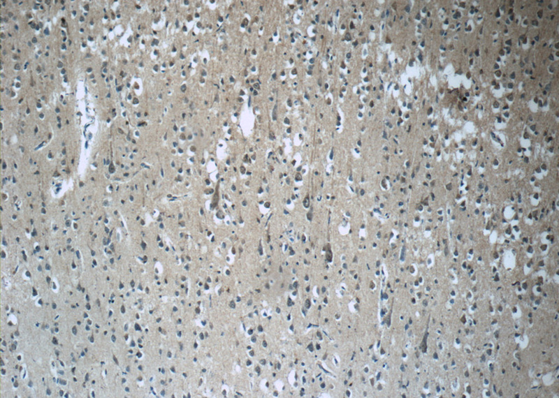 Immunohistochemistry of paraffin-embedded human brain tissue slide using Catalog No:114446(RAB3GAP2 Antibody) at dilution of 1:50 (under 10x lens)