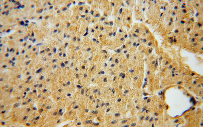 Immunohistochemical of paraffin-embedded human heart using Catalog No:115324(SLC25A15 antibody) at dilution of 1:50 (under 40x lens)