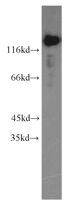 HeLa cells were subjected to SDS PAGE followed by western blot with Catalog No:116053(THRAP3 antibody) at dilution of 1:500