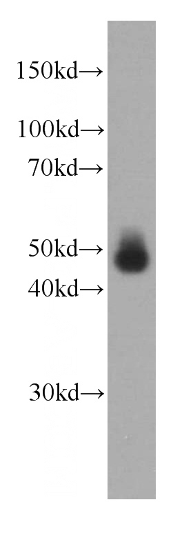 HeLa cells were subjected to SDS PAGE followed by western blot with Catalog No:107577(GLA antibody) at dilution of 1:1000