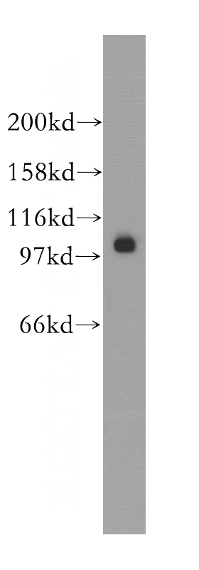 HEK-293 cells were subjected to SDS PAGE followed by western blot with Catalog No:115047(SALL2 antibody) at dilution of 1:300