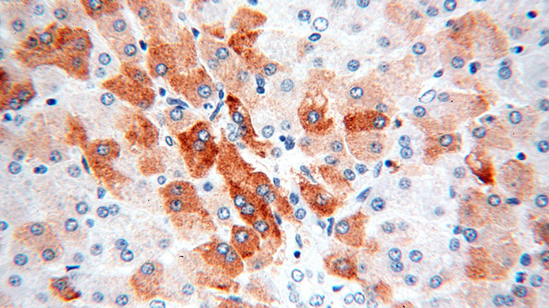 Immunohistochemical of paraffin-embedded human liver using Catalog No:115085(SEC61A1 antibody) at dilution of 1:100 (under 40x lens)