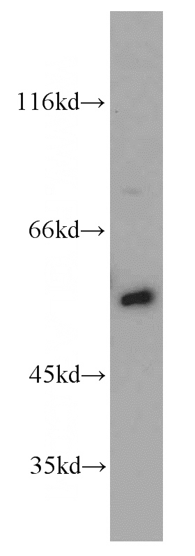 HeLa cells were subjected to SDS PAGE followed by western blot with Catalog No:115419(SMAD4 antibody) at dilution of 1:300
