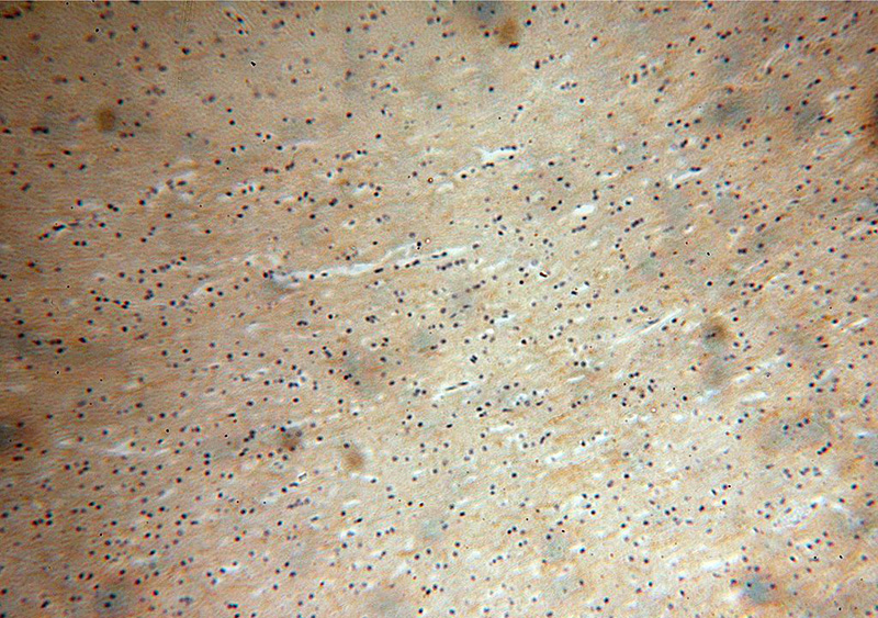 Immunohistochemical of paraffin-embedded human brain using Catalog No:110965(GHITM antibody) at dilution of 1:50 (under 10x lens)
