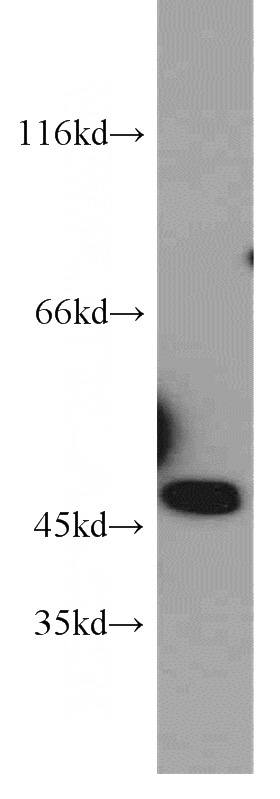 HepG2 cells were subjected to SDS PAGE followed by western blot with Catalog No:113224(NPTX1 antibody) at dilution of 1:400