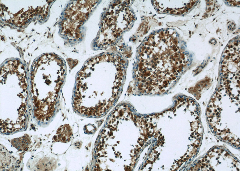 Immunohistochemistry of paraffin-embedded human testis tissue slide using Catalog No:113102(NEK2 Antibody) at dilution of 1:50 (under 10x lens)