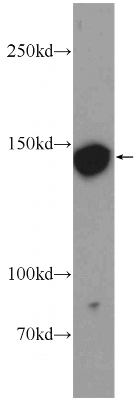 human placenta tissue were subjected to SDS PAGE followed by western blot with Catalog No:114284(PRUNE2 Antibody) at dilution of 1:500