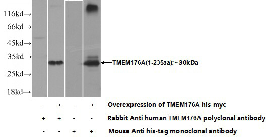 Transfected HEK-293 cells were subjected to SDS PAGE followed by western blot with Catalog No:116107(TMEM176A Antibody) at dilution of 1:700