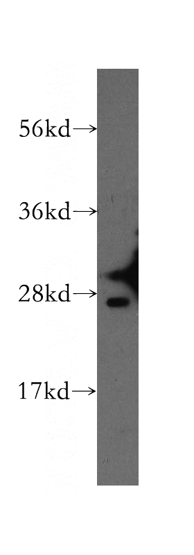 HEK-293 cells were subjected to SDS PAGE followed by western blot with Catalog No:111180(GSTA2 antibody) at dilution of 1:100