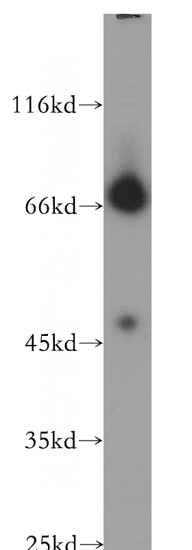 SGC-7901 cells were subjected to SDS PAGE followed by western blot with Catalog No:113239(NLGN4Y antibody) at dilution of 1:600