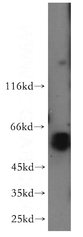 Raji cells were subjected to SDS PAGE followed by western blot with Catalog No:114231(PRPF4 antibody) at dilution of 1:500