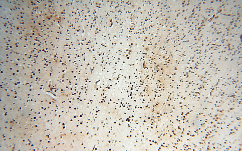 Immunohistochemical of paraffin-embedded human brain using Catalog No:111301(HESX1 antibody) at dilution of 1:50 (under 10x lens)