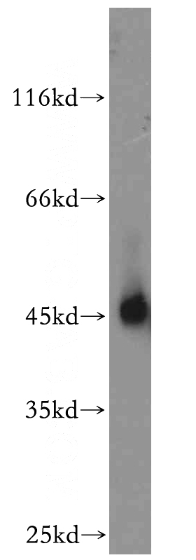 Sp2/0 cells were subjected to SDS PAGE followed by western blot with Catalog No:113232(NR1H3 antibody) at dilution of 1:800