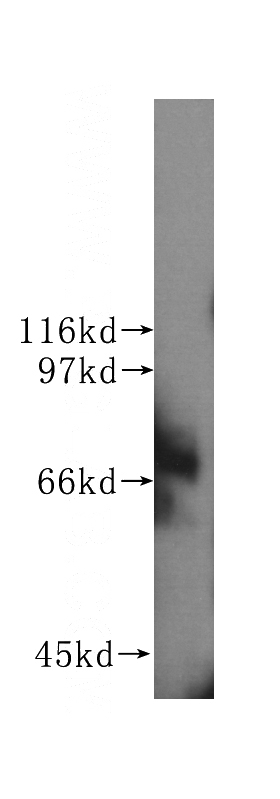 Jurkat cells were subjected to SDS PAGE followed by western blot with Catalog No:107082(BCRP,ABCG2 antibody) at dilution of 1:500