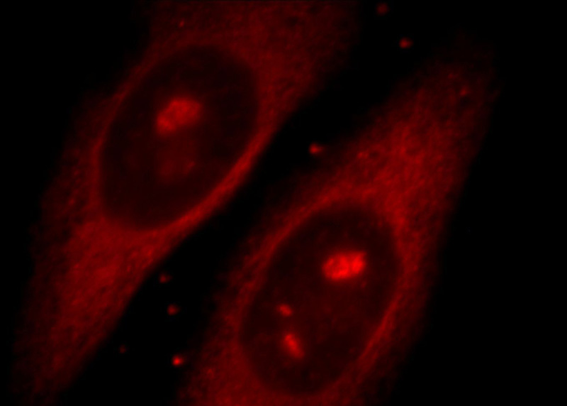 Immunofluorescent analysis of HepG2 cells, using REPS2 antibody Catalog No:114691 at 1:25 dilution and Rhodamine-labeled goat anti-rabbit IgG (red).