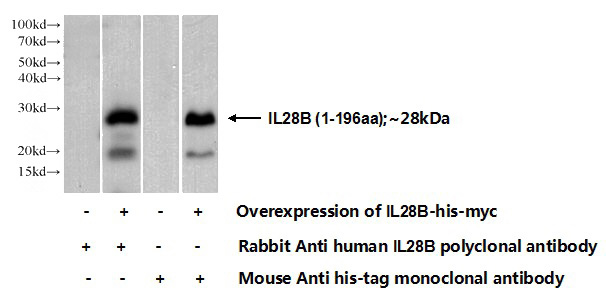 Transfected HEK-293 cells were subjected to SDS PAGE followed by western blot with Catalog No:111731(IL28B Antibody) at dilution of 1:700