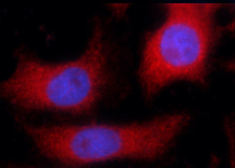 Immunofluorescent analysis of MCF-7 cells using Catalog No:108169(ARPC5L Antibody) at dilution of 1:25 and Rhodamine-Goat anti-Rabbit IgG