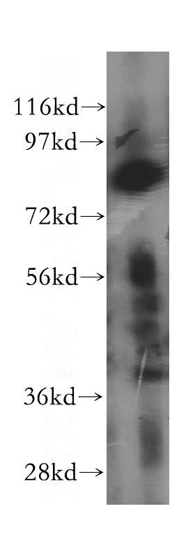 human kidney tissue were subjected to SDS PAGE followed by western blot with Catalog No:111870(INTS10 antibody) at dilution of 1:500